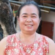 คุณดลพร โรคมะเร็งเต้านม แพ้คีโม